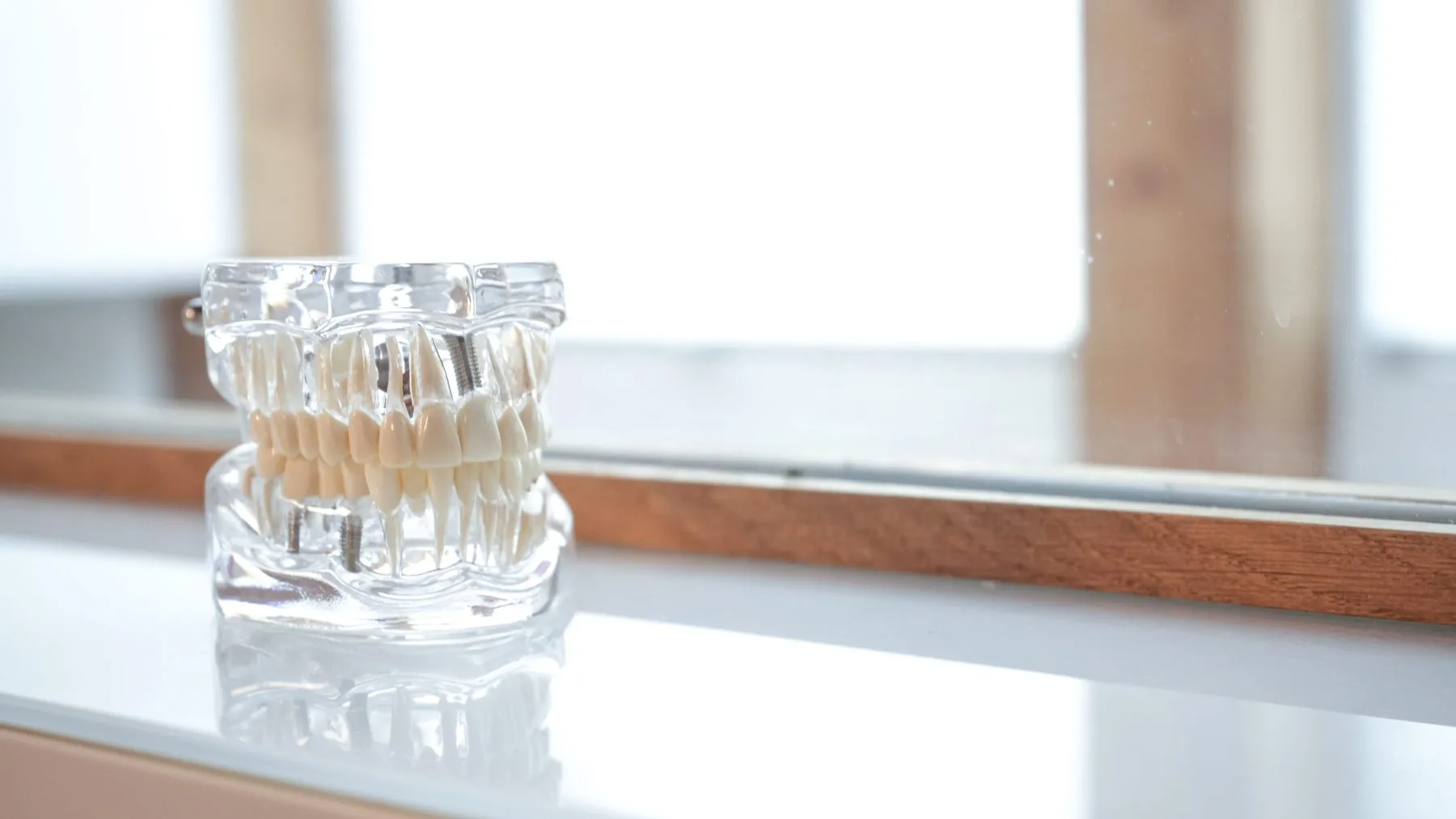 Zahnmodell im Dental Spa Konstanz